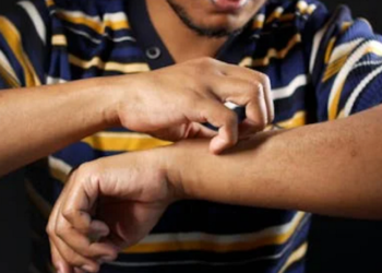 5 dấu hiệu trên da cảnh báo gan bị tổn thương mà không biết